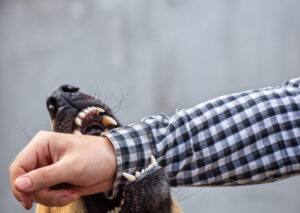 How Jay Murray Personal Injury Lawyers Can Help After a Dog Bite in Dallas, TX